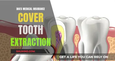 Tooth Extraction: Unlocking Medical Insurance Coverage