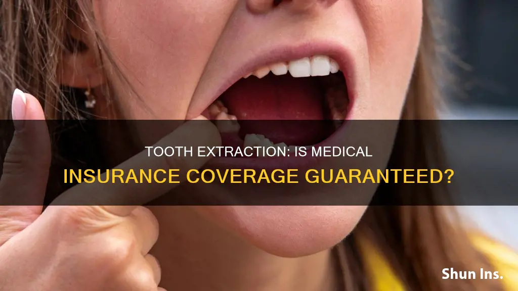 does medical insurance cover tooth extraction