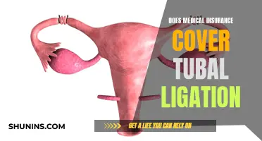 Tubal Ligation: Medical Insurance Coverage and What's Included