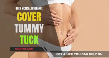 Tummy Tuck Coverage: Understanding Medical Insurance Options