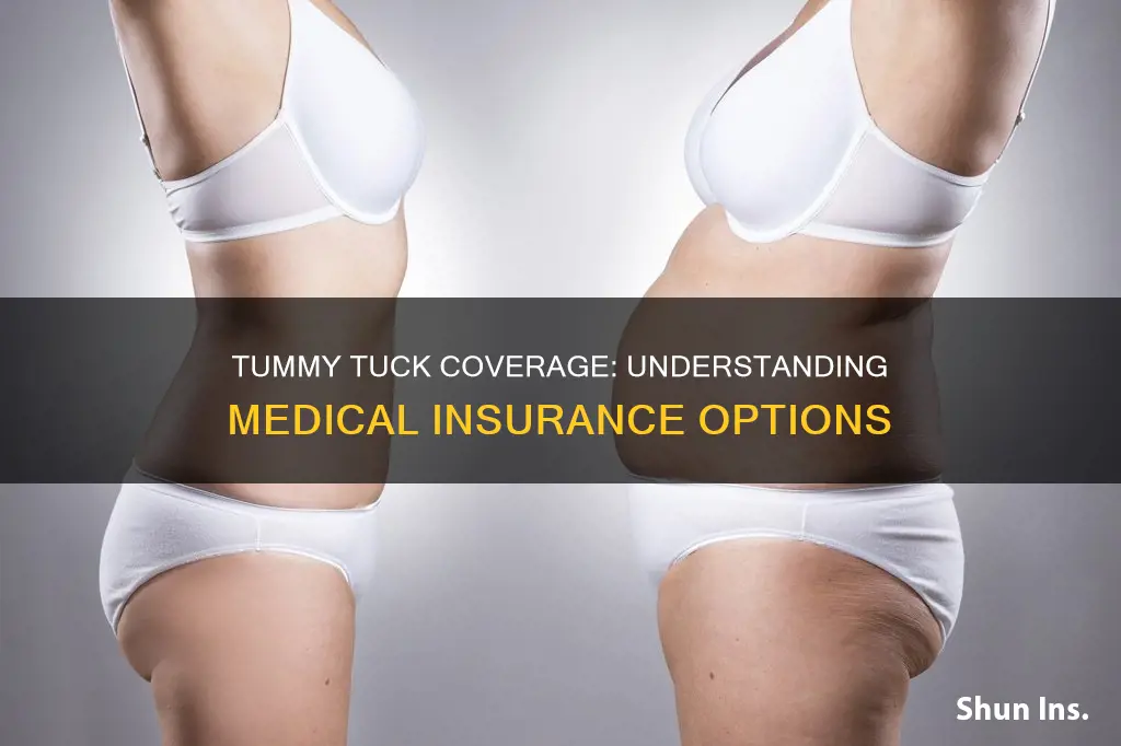 does medical insurance cover tummy tuck