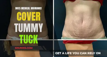 Medical Insurance and Tummy Tucks: What's Covered?