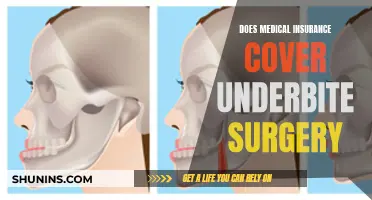 Medical Insurance and Underbite Surgery: What's Covered?