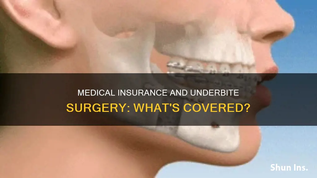 does medical insurance cover underbite surgery