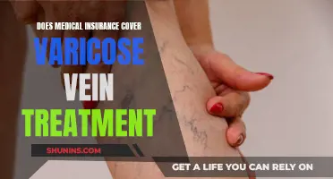 Varicose Vein Treatment: Is Medical Insurance Coverage Available?