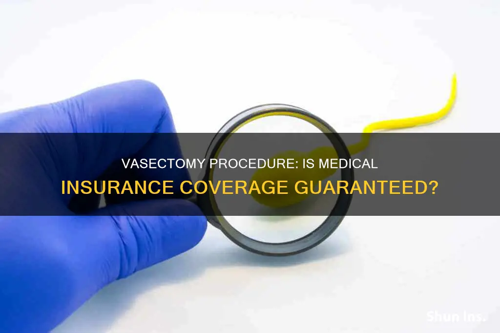 does medical insurance cover vasectomy