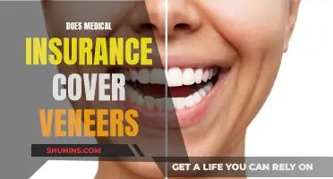 Veneers and Insurance: What's Covered and What's Not