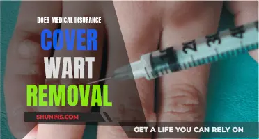 Medical Insurance Wart Removal: What You Need to Know