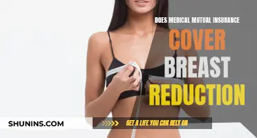 Breast Reduction Surgery: Is Medical Mutual Insurance Coverage Available?