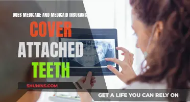 Medicare and Medicaid: Attached Teeth Coverage Explained
