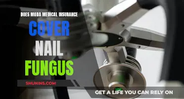 Moda Medical Insurance: Does It Cover Nail Fungus?