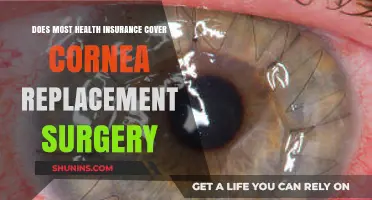 Is Cornea Replacement Surgery Covered by Your Health Insurance?