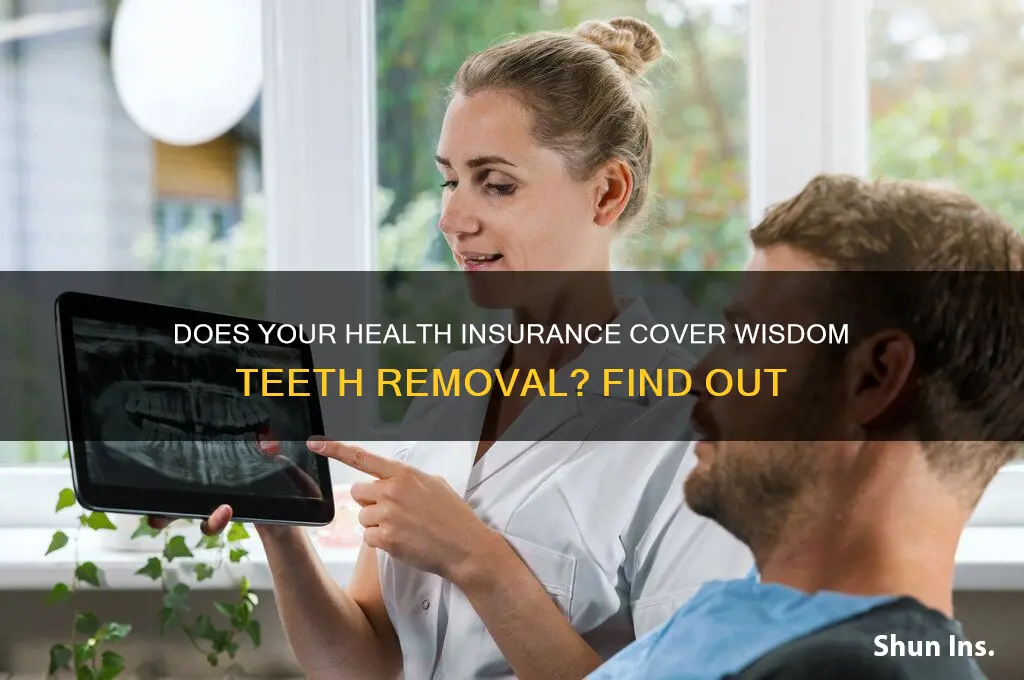 does most health insurance cover wisdom teeth removal