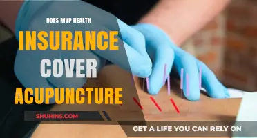Does MVP Health Insurance Cover Acupuncture? Benefits Explained