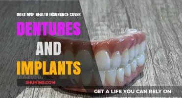 Does MVP Health Insurance Cover Dentures and Implants? Find Out