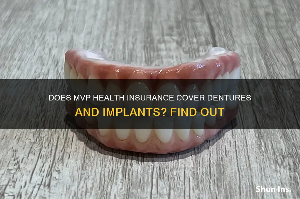 does mvp health insurance cover dentures and implants