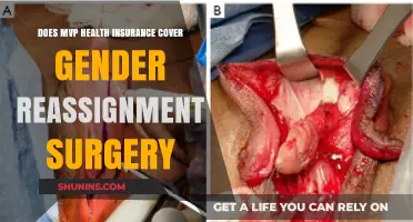 Does MVP Health Insurance Cover Gender Reassignment Surgery?