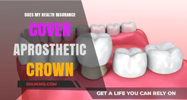 Does Your Health Insurance Cover a Prosthetic Crown? Find Out