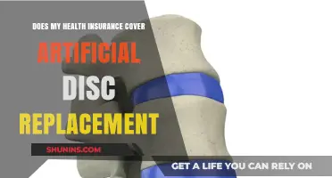 Does Health Insurance Cover Artificial Disc Replacement? What to Know