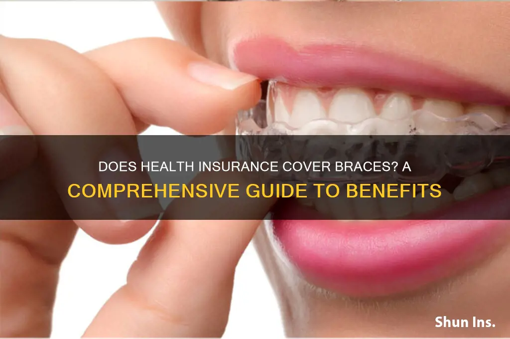 does my health insurance cover braces