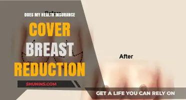 Does Health Insurance Cover Breast Reduction? What You Need to Know