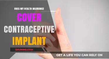Contraceptive Implant Coverage: What Your Health Insurance May Include