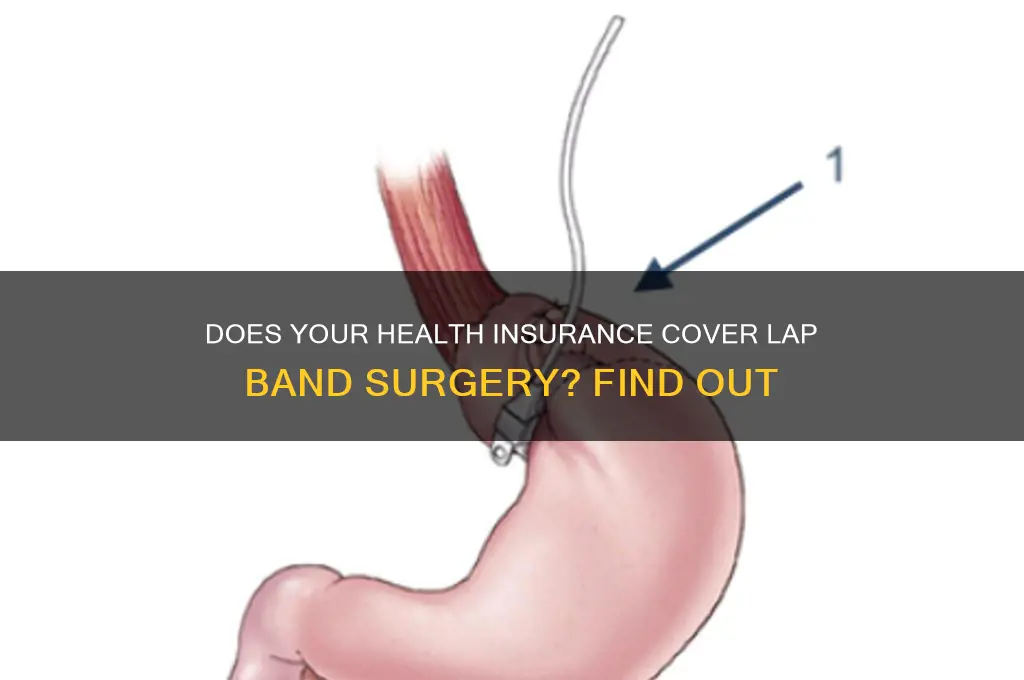 does my health insurance cover lap band surgery