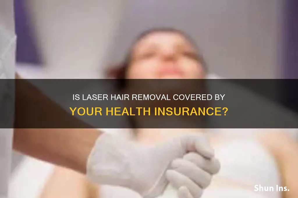 does my health insurance cover laser hair removal
