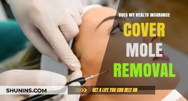 Health Insurance and Mole Removal: What’s Covered and What’s Not?