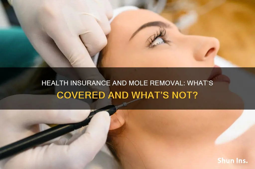does my health insurance cover mole removal