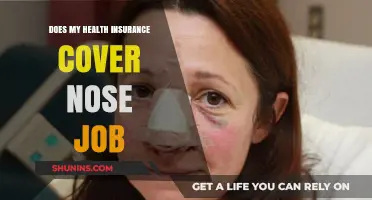 Does Health Insurance Cover Rhinoplasty? What You Need to Know