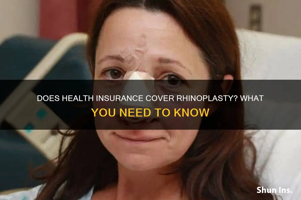 does my health insurance cover nose job