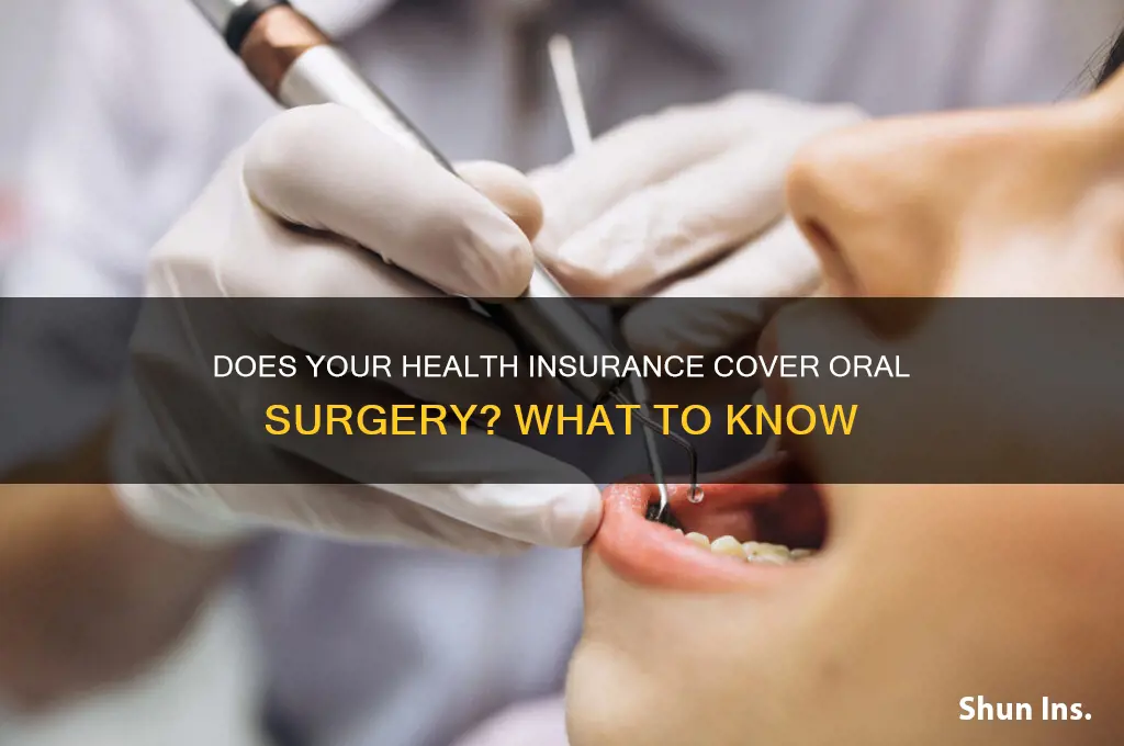 does my health insurance cover oral surgery