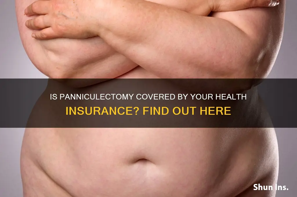 does my health insurance cover panniculectomy