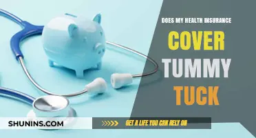 Does Health Insurance Cover Tummy Tucks? What You Need to Know