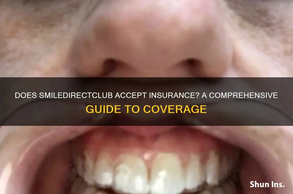 does my smile direct except insurance