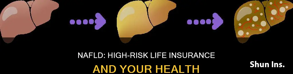 does nafld make me high risk for life insurance