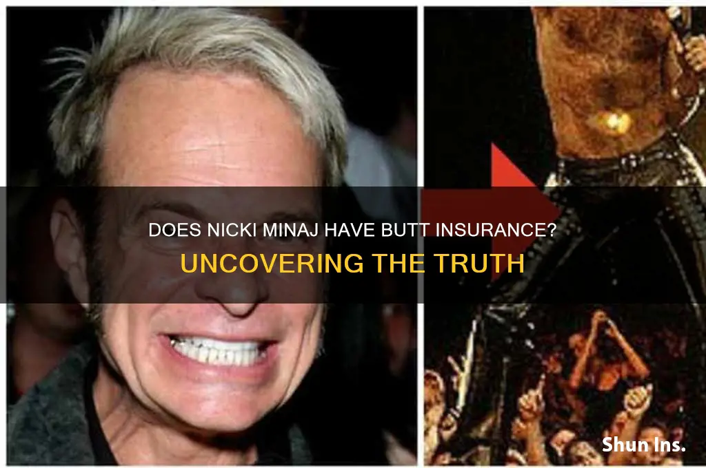 does nicky minage have butt insurence