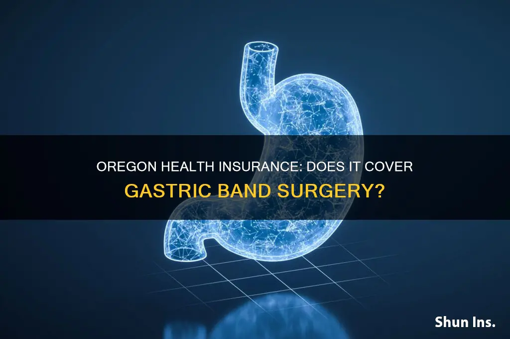does oregon health insurance cover gastric band