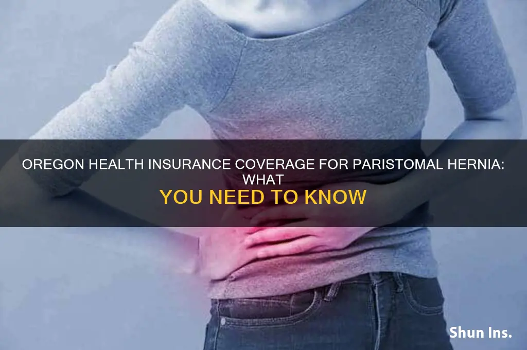 does oregon health insurance cover paristoma hernia