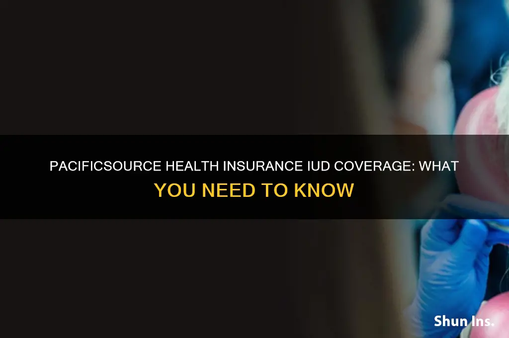 does pacific source health insurance cover iud