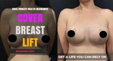 Does Private Health Insurance Cover Breast Lift Procedures?