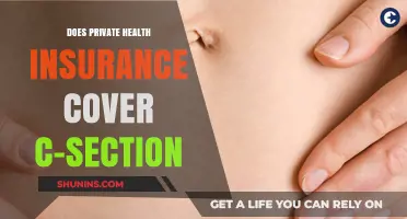 Does Private Health Insurance Cover C-Section Deliveries?