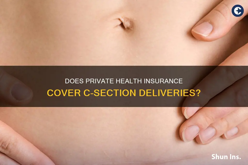 does private health insurance cover c-section