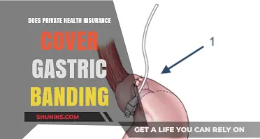 Does Private Health Insurance Cover Gastric Banding? What You Need to Know