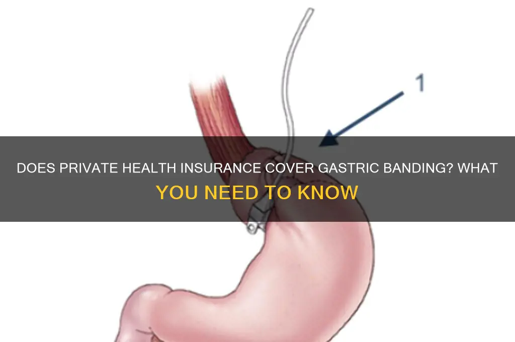 does private health insurance cover gastric banding