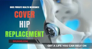 Does Private Health Insurance Cover Hip Replacement? What You Need to Know