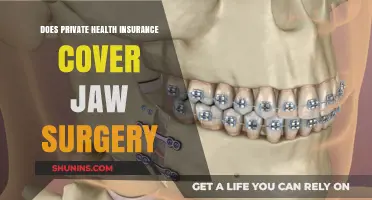 Does Private Health Insurance Cover Jaw Surgery? What You Need to Know