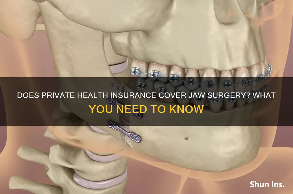 does private health insurance cover jaw surgery