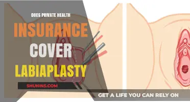 Does Private Health Insurance Cover Labiaplasty? What You Need to Know